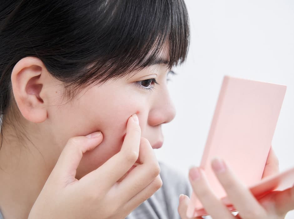Acne Clinic in London