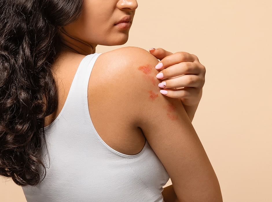 Allergy Clinic in London