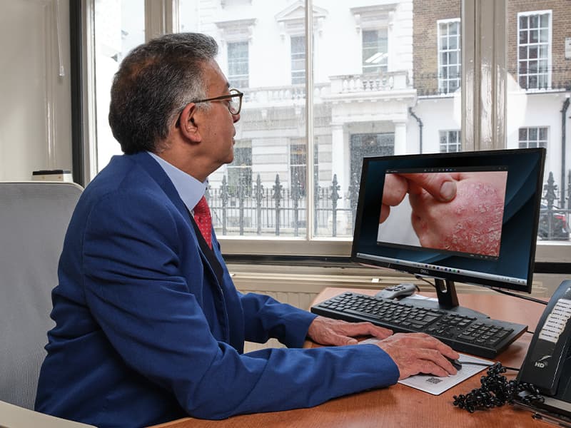 Psoriasis clinic