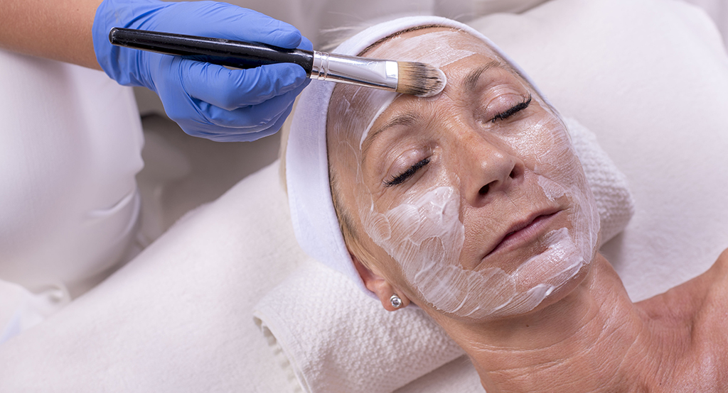 Facial Peels