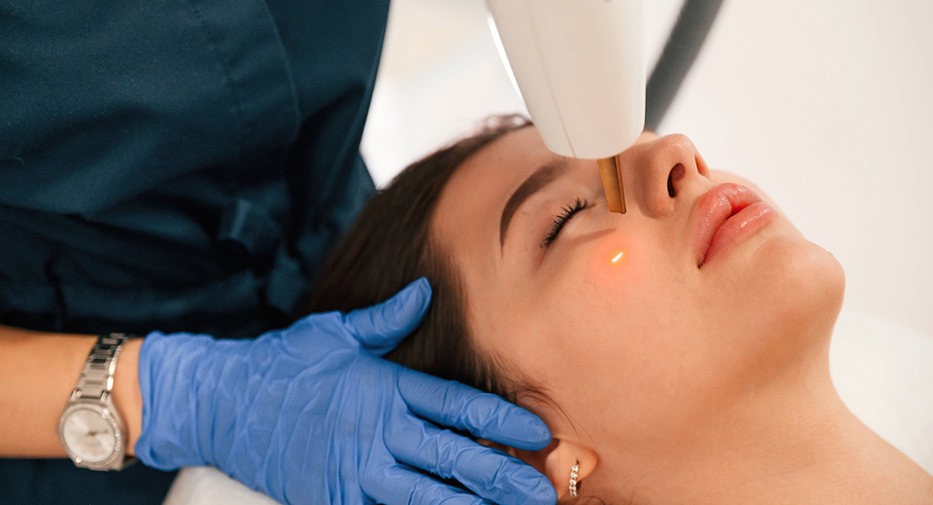 Laser Treatments
