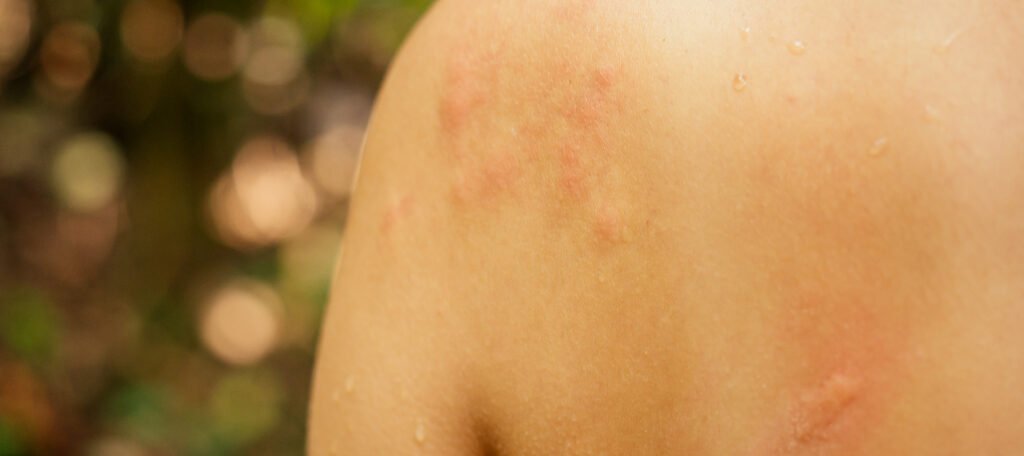 Allergists