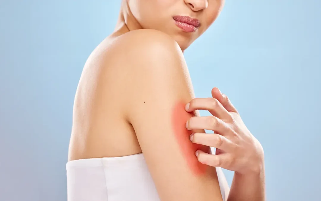 Skin Sensitivity vs Skin Allergy: How Dermatologists Tell the Difference