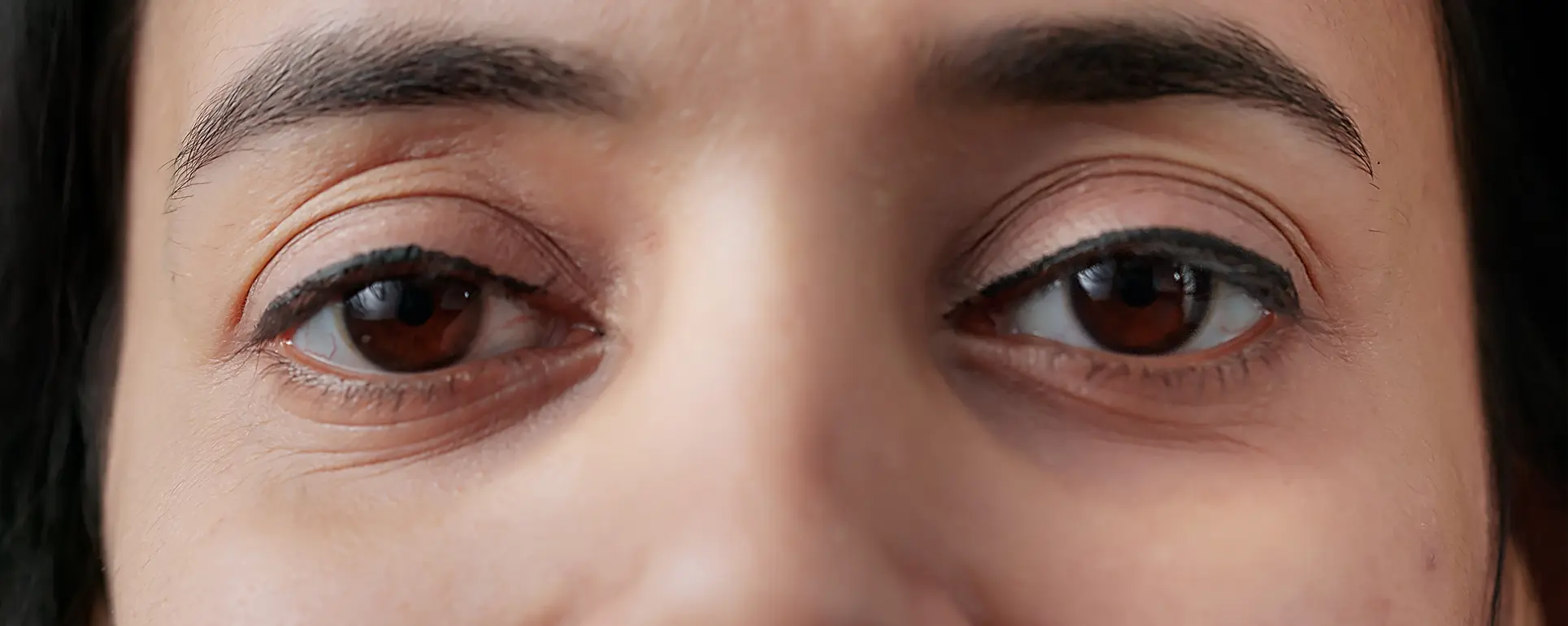 Puffy eyes 01