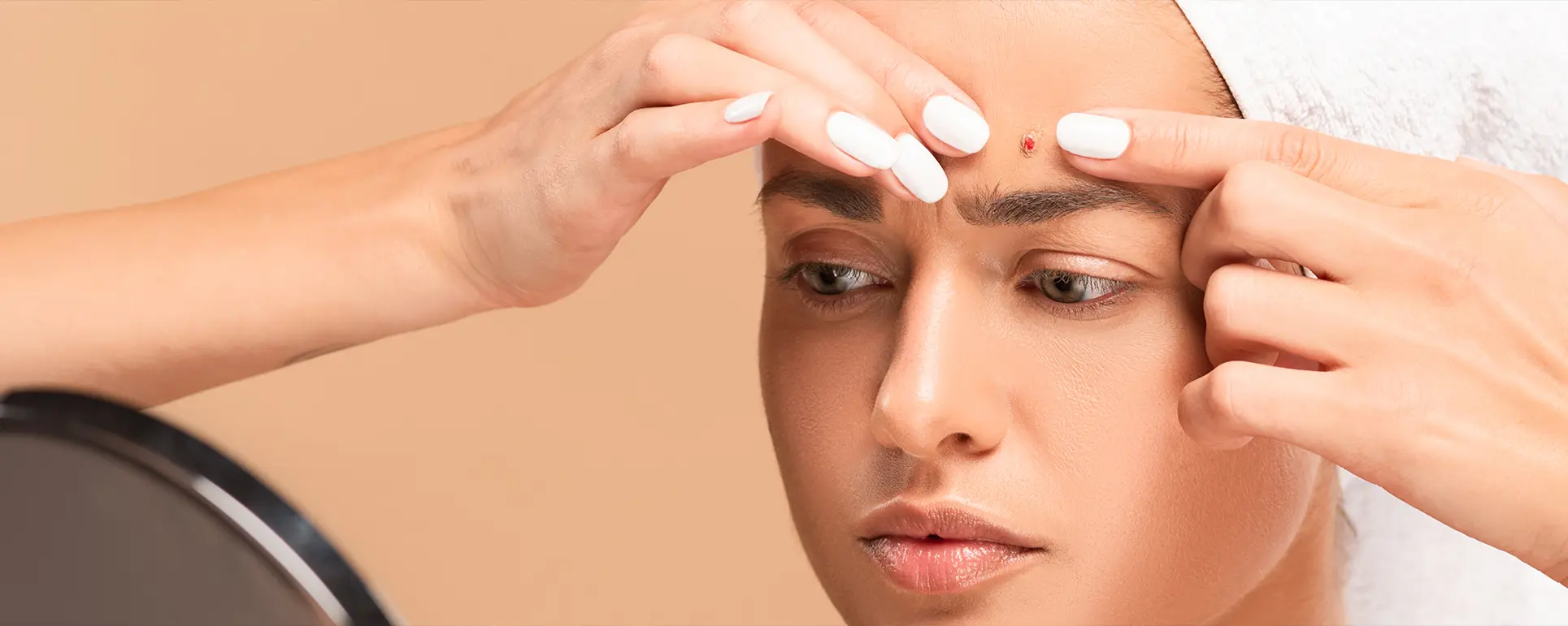 acne forehead 3