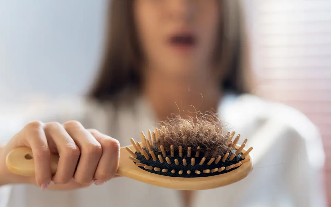 Teenage Alopecia: When Hair Loss Starts Early