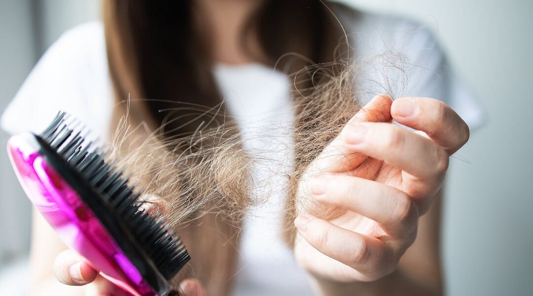 Alopecia and Scalp Inflammation: When It’s More Than Just Hair Loss