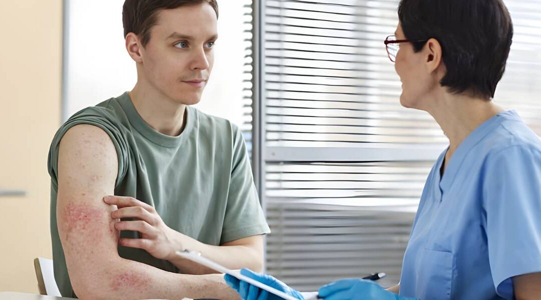 Filaggrin Gene Mutations and Eczema: What the Research Shows