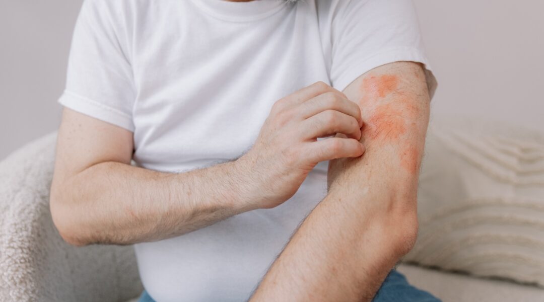 Skin Irritation vs Skin Inflammation: Why the Difference Matters