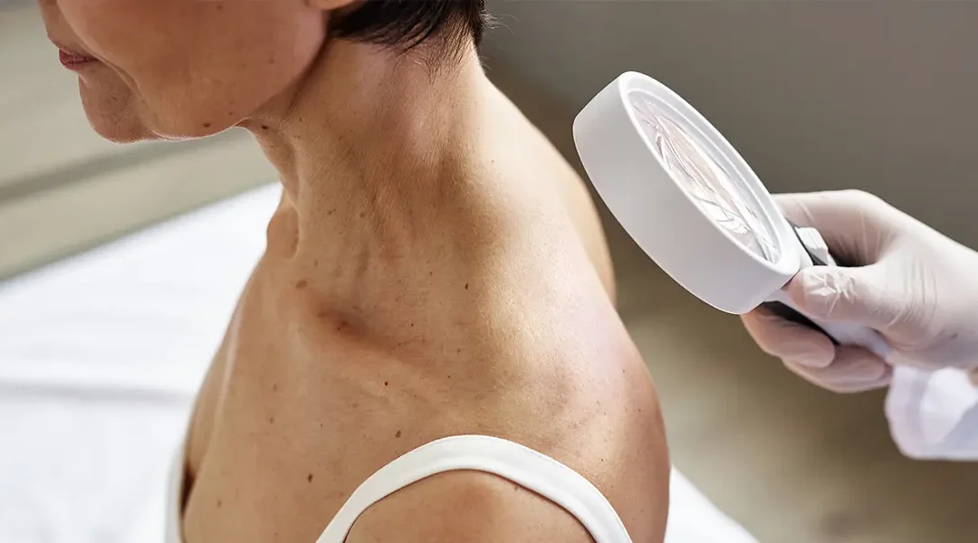 Skin Barrier Damage: How to Recognise It and Repair It Properly