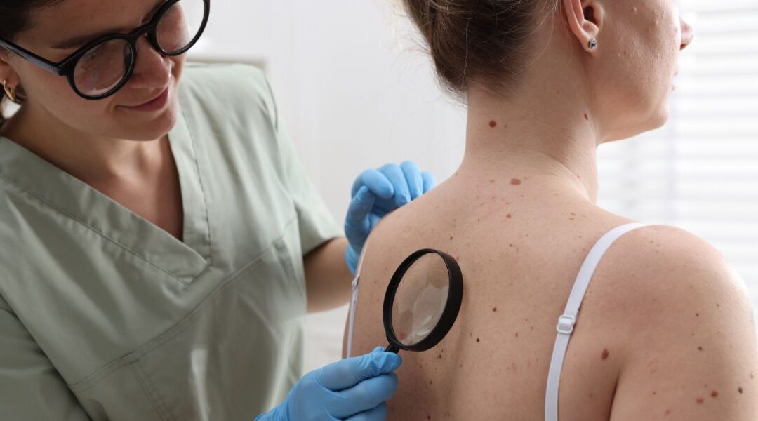 When a Skin Condition Doesn’t Fit the Textbook: How Dermatologists Handle Unclear Diagnoses