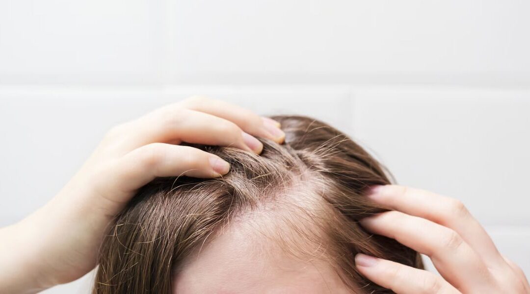 Trichoscopy in Alopecia: Diagnostic Patterns That Change Management