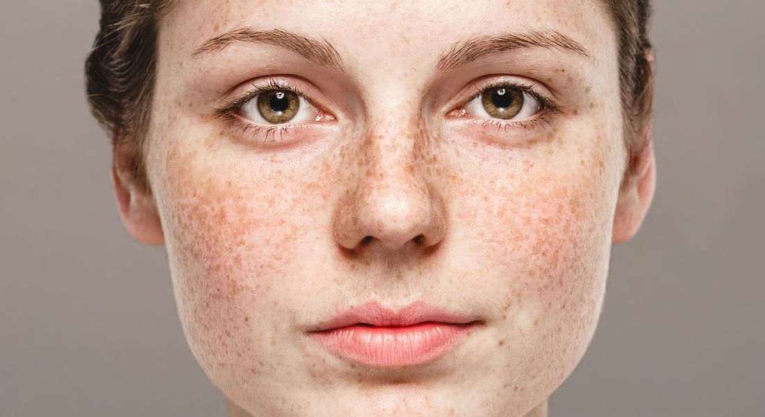 Why One Person’s “Holy Grail” Skincare Makes Another Person’s Skin Worse