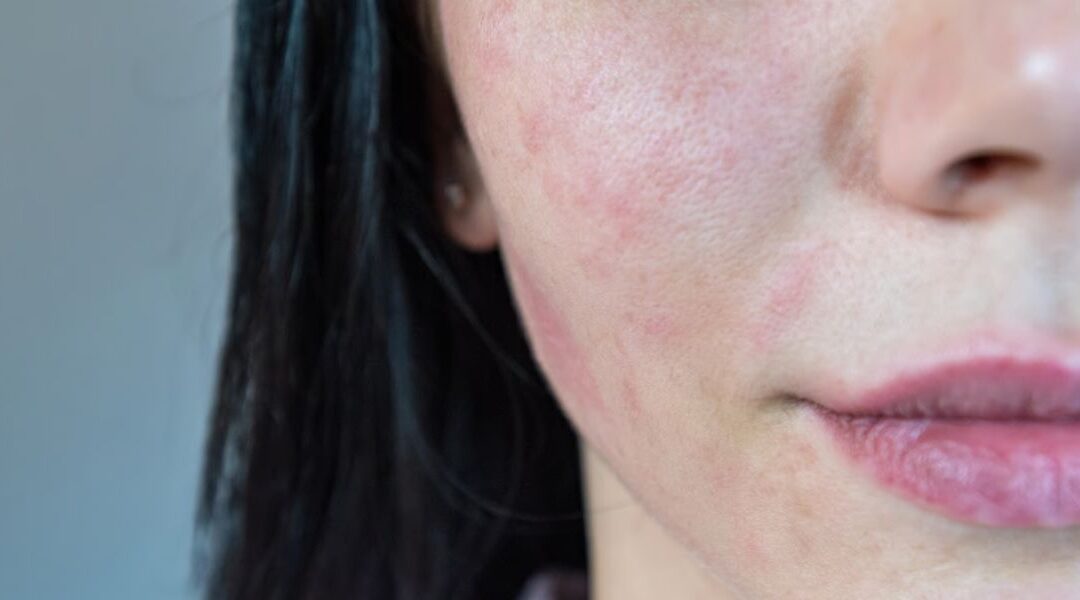 Why Your Skin Looks Worse Before It Gets Better (And When That’s a Red Flag)