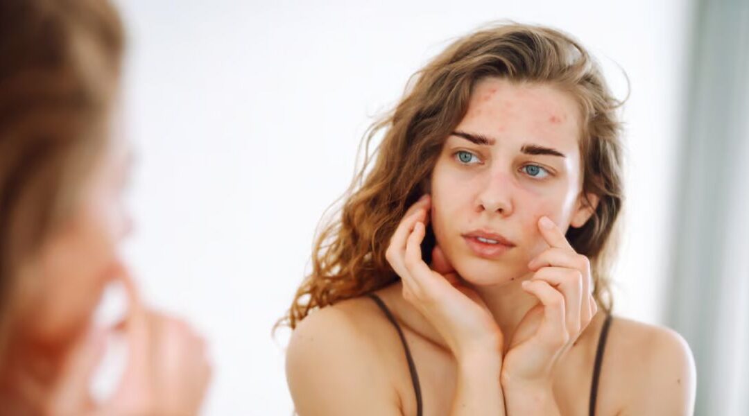 Why Skin Conditions Can Feel Worse Than They Look