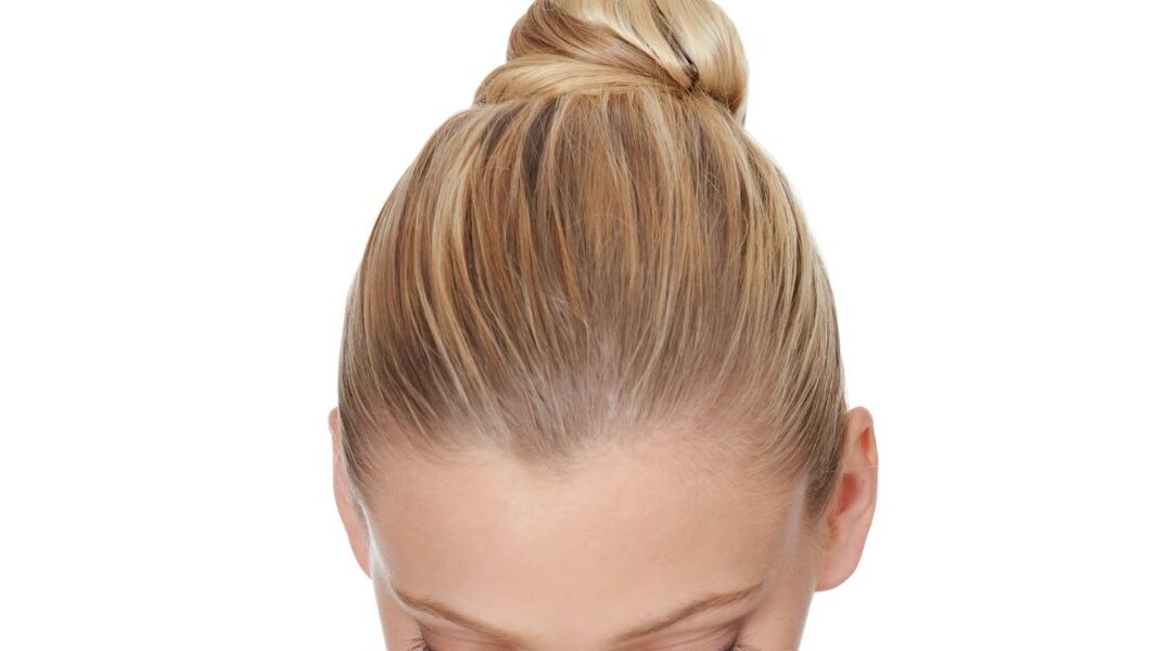 Traction Alopecia: Is Tight Styling Damaging Your Hairline?