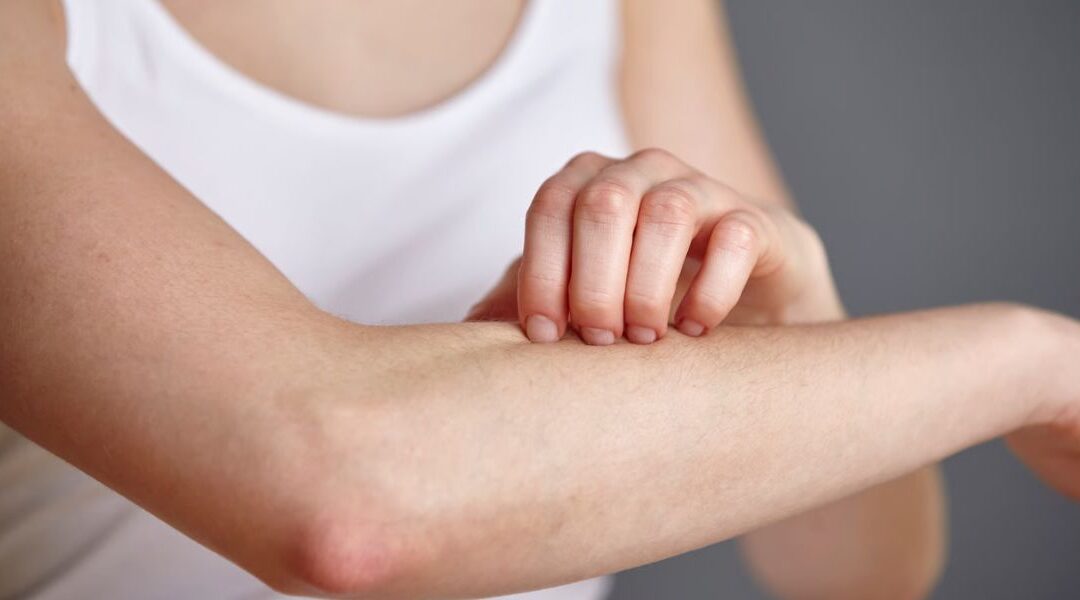 Itchy Skin with No Rash: What Could Be Causing It? 