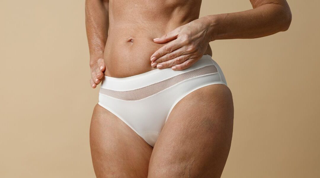 Lichen Sclerosus in Women: Early Signs, Diagnosis and Why It Shouldn’t Be Ignored