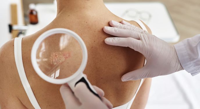 Next-Generation Biologics in Dermatology_ What’s Emerging Beyond Current Therapies