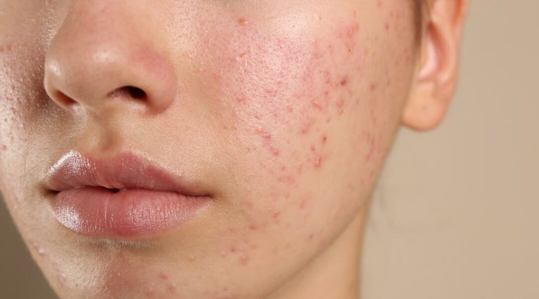 Why Skin Reacts to Products Used for Years (Explained)