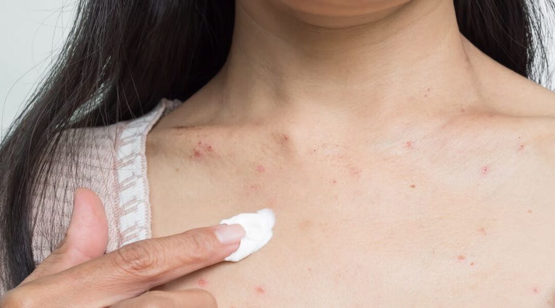 Environmental Dermatology: How Pollution  Is Changing Skin Disease Patterns