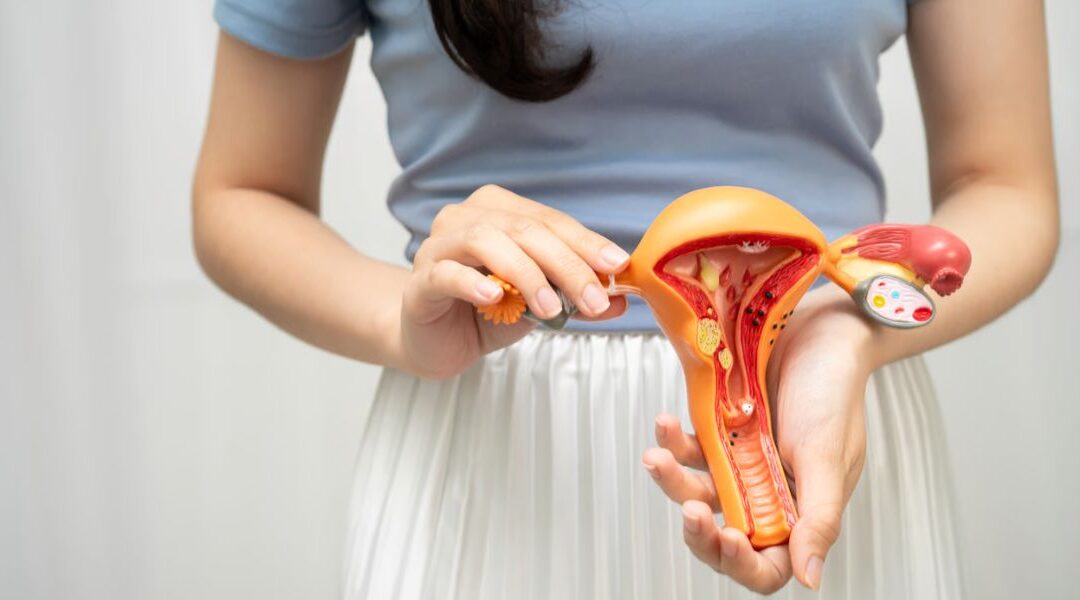Lichen Planus of the Vulva: Symptoms, Diagnosis and Treatment