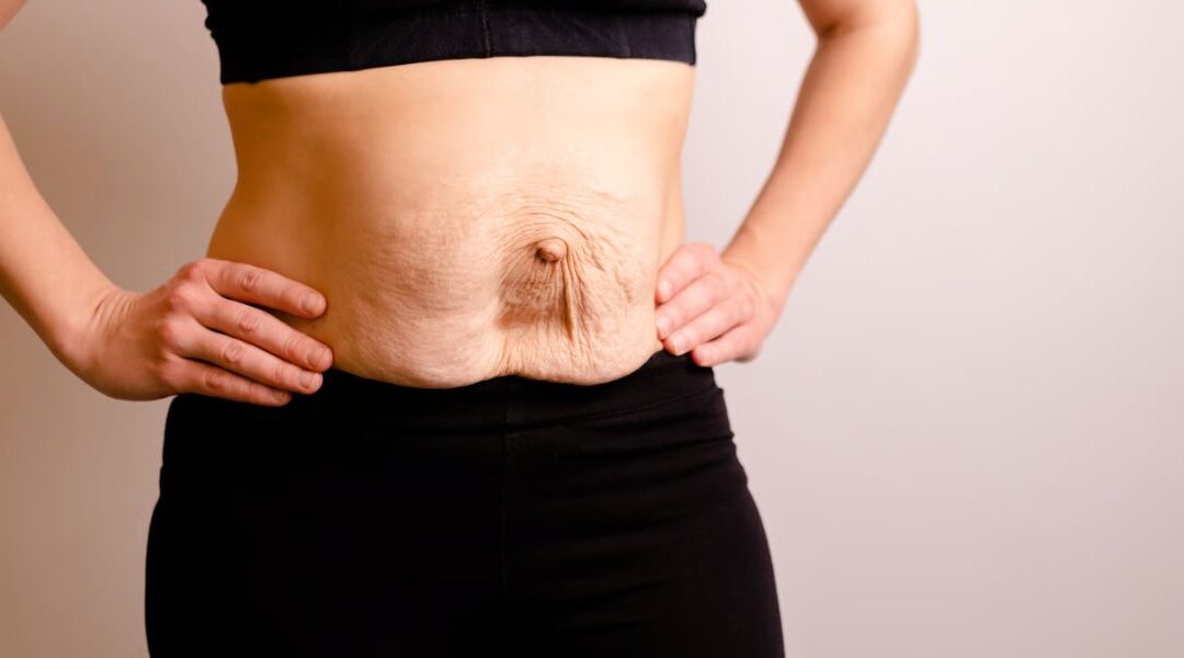 Postpartum Skin Changes: Dermatological Conditions After Pregnancy