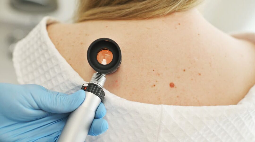 Can Basal Cell Carcinoma Be Pigmented or Dark in Colour?