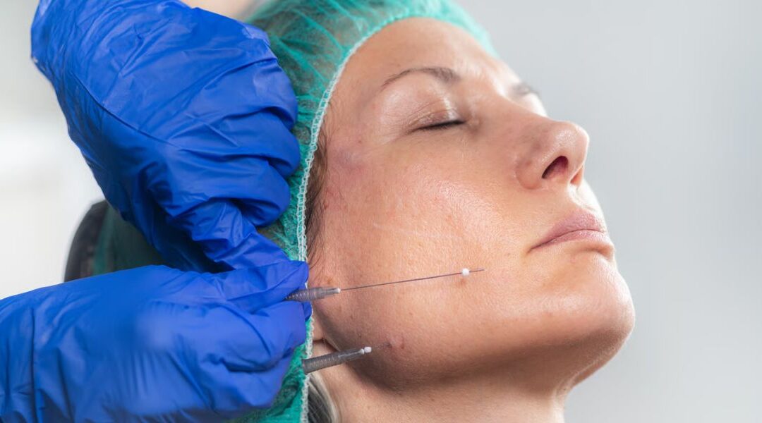 What Are the Risks and Side Effects of a Thread Lift?