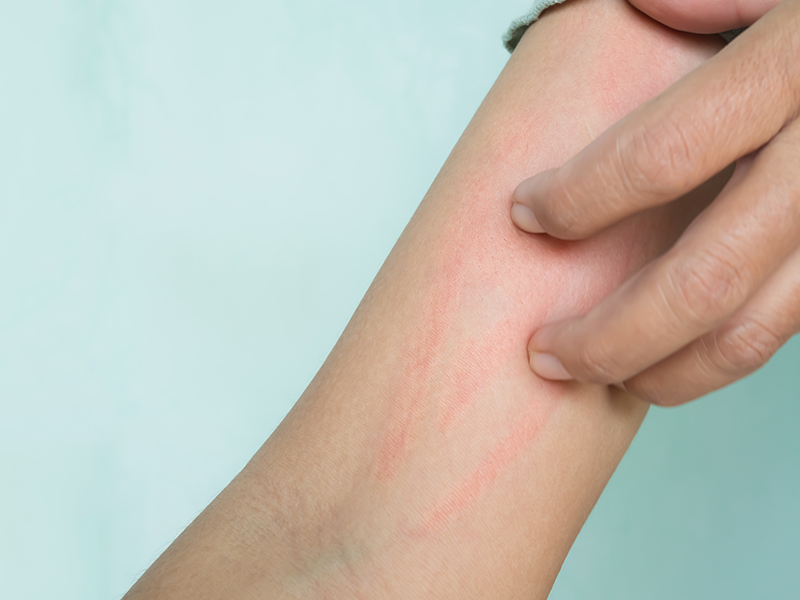 allergy treatment clinic