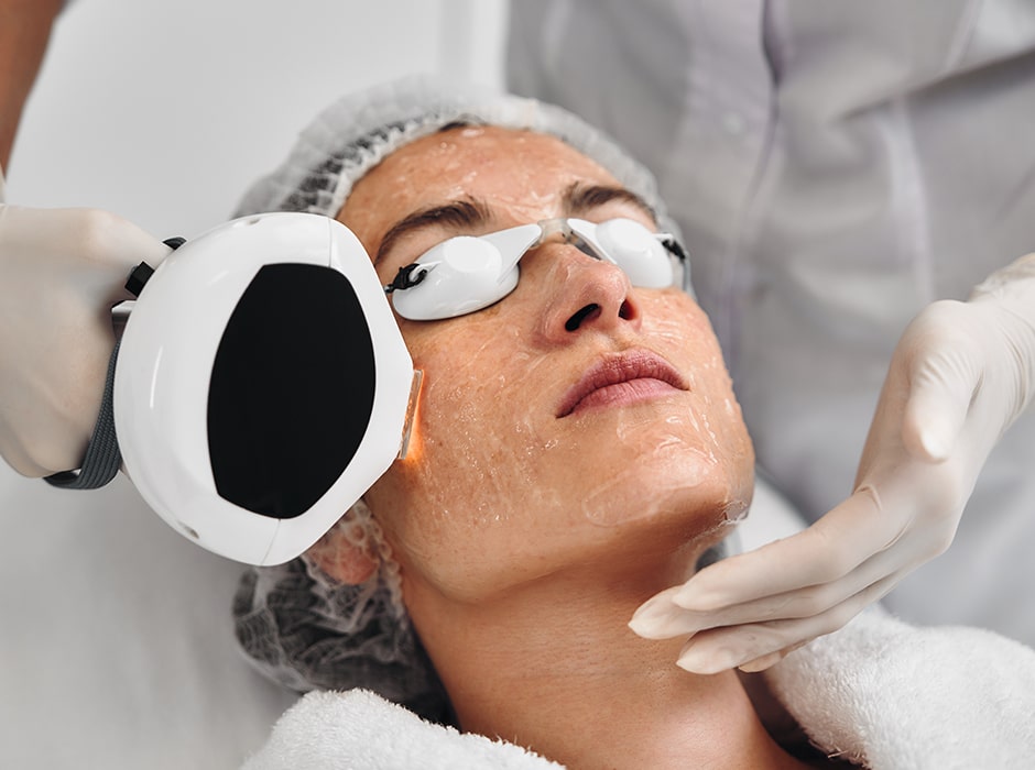 Rosacea Treatment Clinic in London