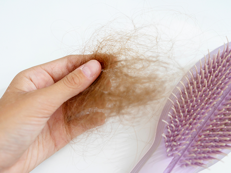 cause of alopecia areata