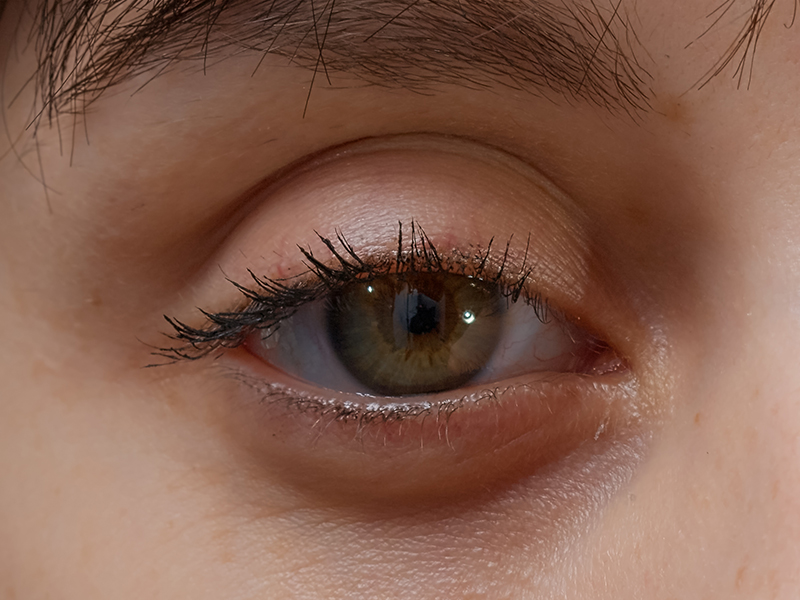 Dark Circles