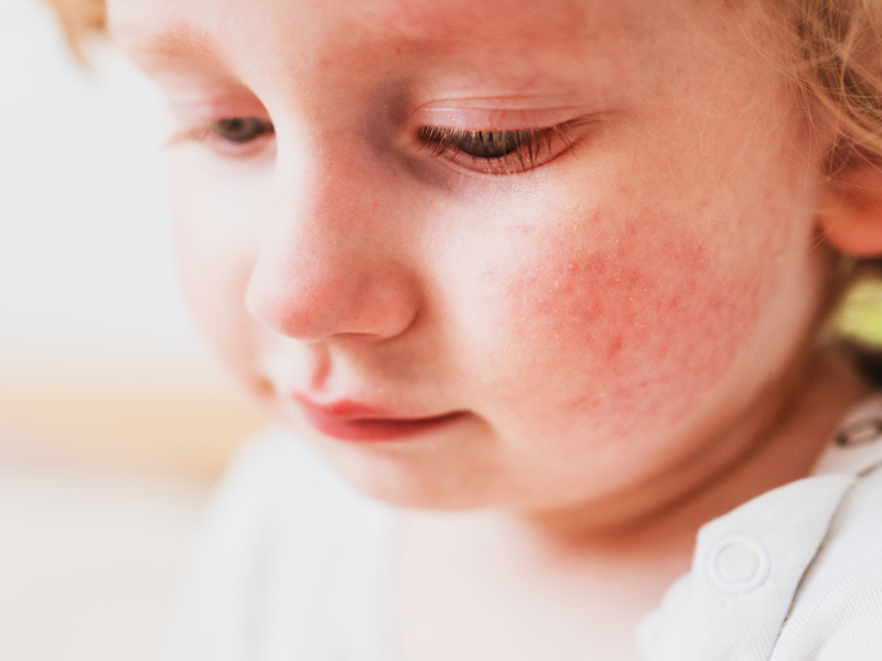 allergy treatment clinic