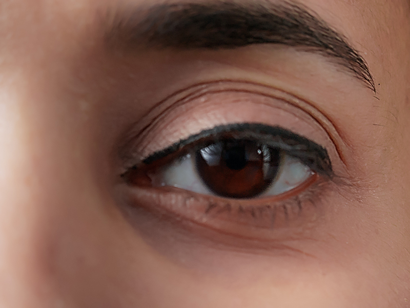 Preventing Dark Circles