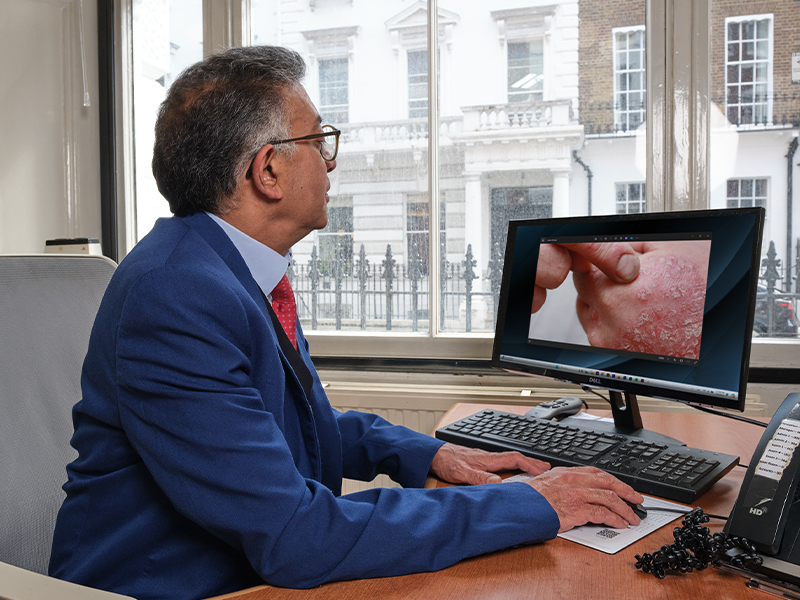 psoriasis clinic