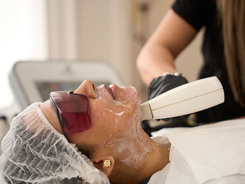 Rosacea Treatment