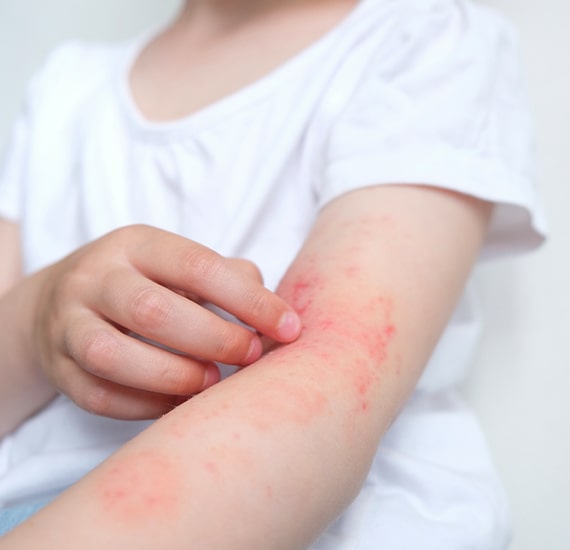 allergy clinic