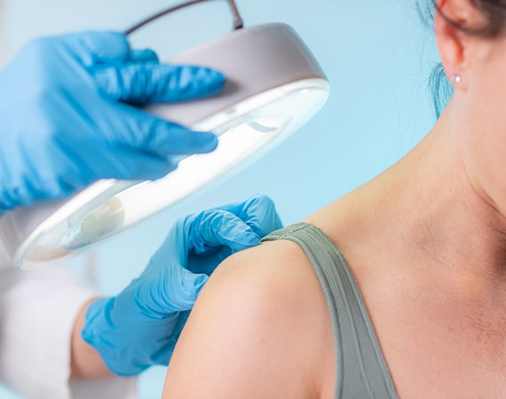benefits of laser tattoo removal