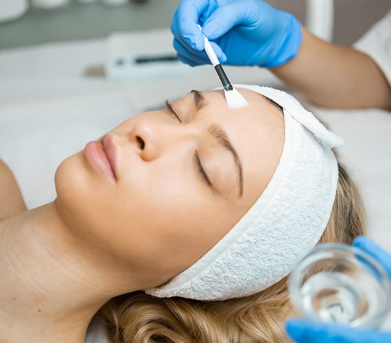 Chemical peels