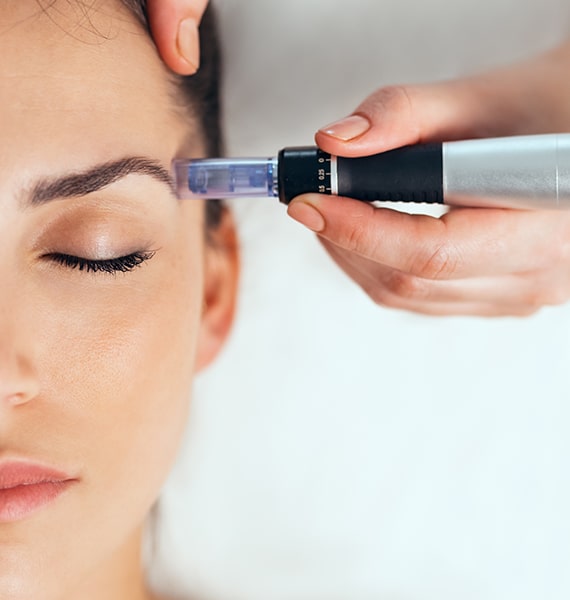dermapen