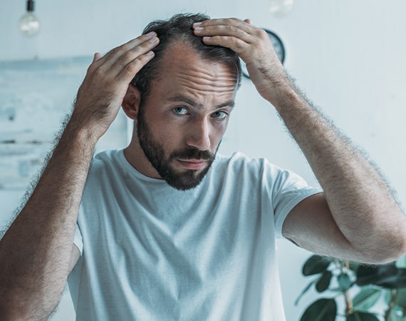hair loss