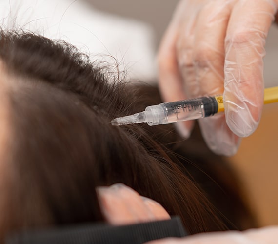 Intralesional Steroid Injections