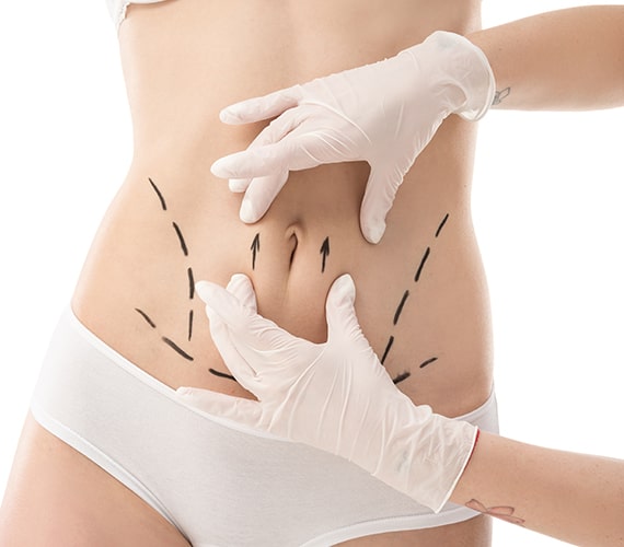 Liposonix Treatment Clinic