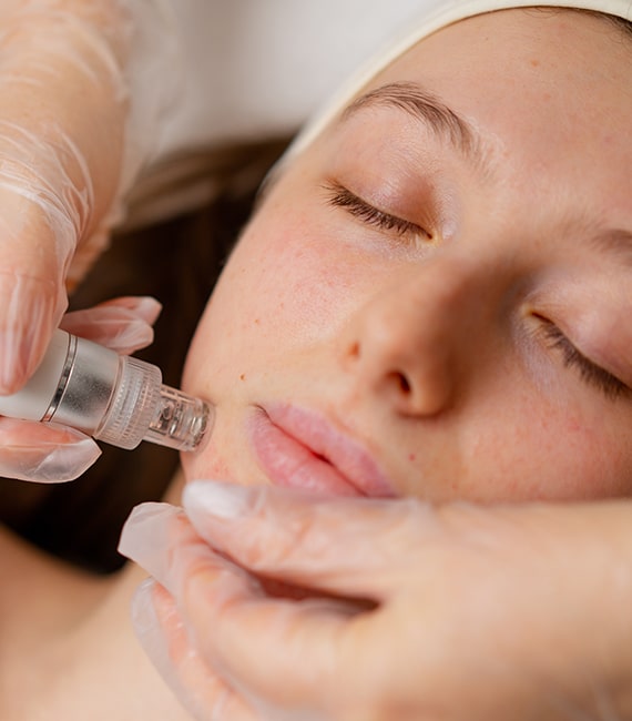 microdermabrasion