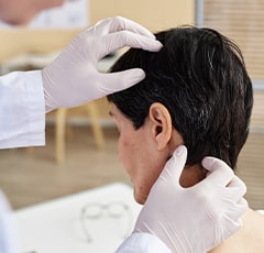 Scalp Psoriasis