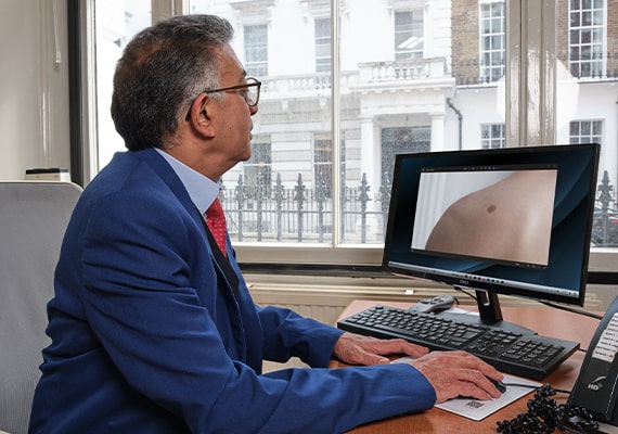 skin cancer consultation
