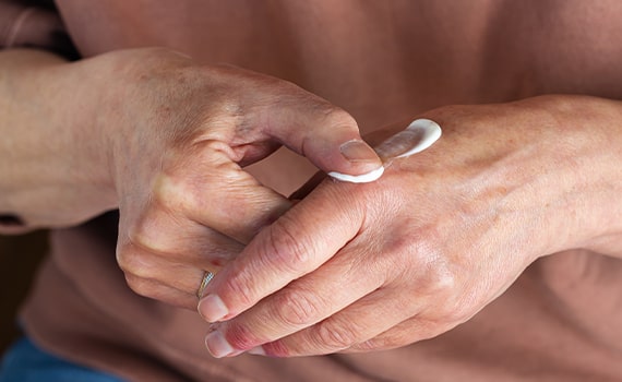 Steroid-alternative treatments