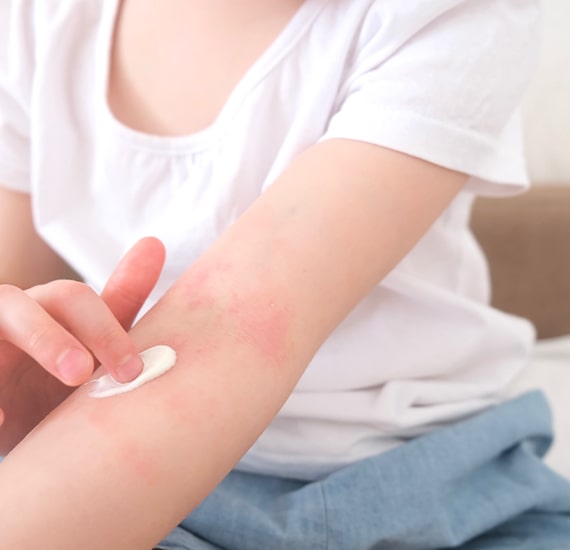 Steroid-alternative treatments