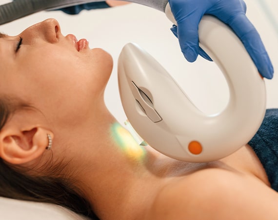 tattoo removal procedure
